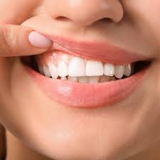 Combatting Gum Disease Effective Strategies For Healthy Gums Fit To Smile Dental