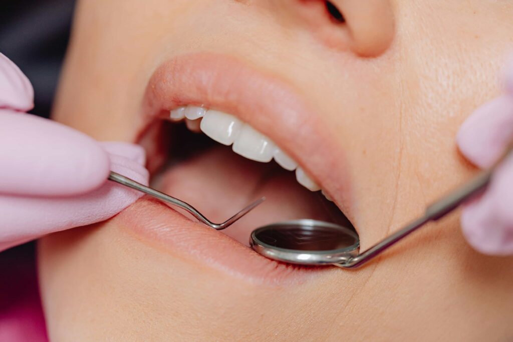 dental work on woman